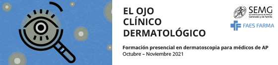 Banner ojo derma 560x132pxV2
