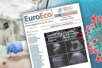 La SEMG expone la utilidad de la ecografía pulmonar en el diagnóstico y seguimiento de la infección por COVID-19