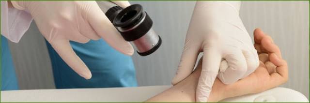 Los centros de salud estrenan una técnica para la detección precoz del cáncer de piel